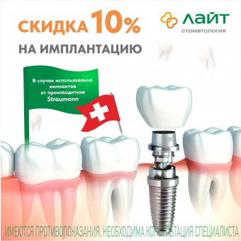 Скидка 10% на имплантацию в Стоматологии Лайт!
