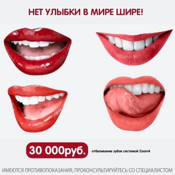 Профессиональное отбеливание зубов Philips Zoom 4⁣⁣ за 30.000 рублей