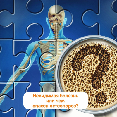 Главное изображение